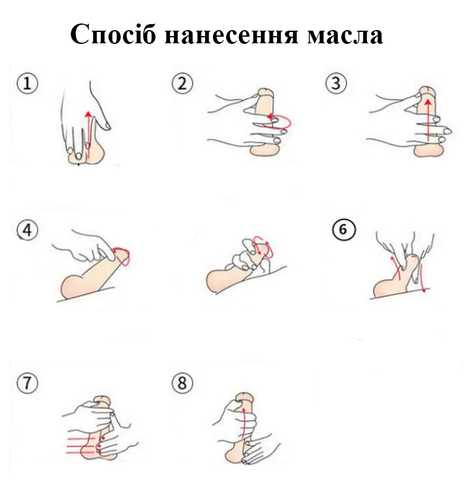 Инъекции в головку полового члена